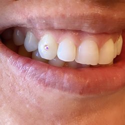 The Smile Studio - Tooth gem !