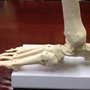 Photo of Northern California Foot & Ankle Center