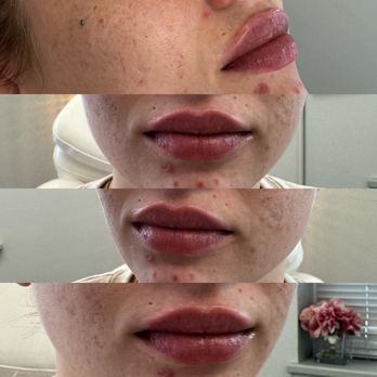 HOPE Cosmetics - Medical Spas Near Me HOPE Cosmetics - Medical Spas Near Me