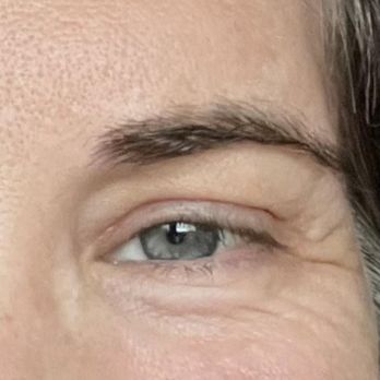 Ivan Vrcek, MD - Photo of left eye, smiling. - Cosmetic Surgeons Near Me - Dallas, Texas Ivan Vrcek, MD - Photo of left eye, smiling. - Cosmetic Surgeons Near Me - Dallas, Texas