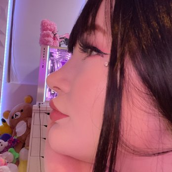 Eugene Kim, MD - Nose 6 months after surgery - Cosmetic Surgeons Near Me - Beverly Hills, California Eugene Kim, MD - Nose 6 months after surgery - Cosmetic Surgeons Near Me - Beverly Hills, California