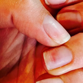 Nail Masters - Painful! (From being some NOT GENTLE and rushing through the gel/shellac removal process by using a drill file) - Nail Technicians Near Me - Mill Creek, Washington Nail Masters - Painful! (From being some NOT GENTLE and rushing through the gel/shellac removal process by using a drill file) - Nail Technicians Near Me - Mill Creek, Washington