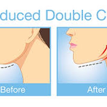 Lucent Cosmetics - Medical Spas Near Me - Glendora, California Lucent Cosmetics - Medical Spas Near Me - Glendora, California