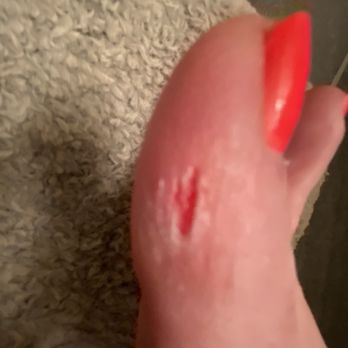 Adela Nails & Spa - Toe with chunk taken out - Nail Salons Near Me - Vancouver, Washington Adela Nails & Spa - Toe with chunk taken out - Nail Salons Near Me - Vancouver, Washington