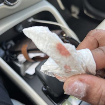 Chase nails - She cut my cuticle so bad it bled and bled!! Horrible service. I refused to let them finish my nail. - Nail Salons Near Me - Coconut Creek, Florida