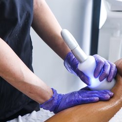 Body Rock Sculpting Med Spa - Cryo Sculpt is a Cold Sculpting method to slimming and toning area's of the body. See 1/2 inch lose with one Cryo Slimming treatment!