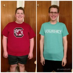 Live Healthy MD - Patient Before and After