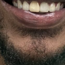 A Plus Dental