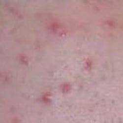 Polley Clinic Of Dermatology