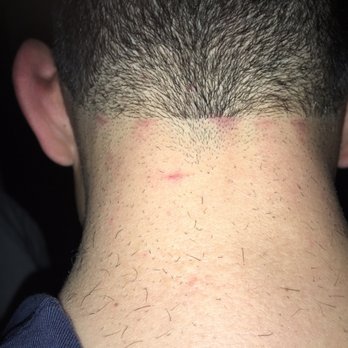 Cost Cutters - Almost 3 days after haircut and still very irritated - Hair Salons Near Me - HOUSTON, Texas Cost Cutters - Almost 3 days after haircut and still very irritated - Hair Salons Near Me - HOUSTON, Texas