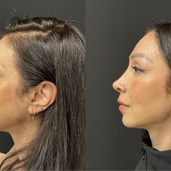 Adam Weinfeld, MD - Cosmetic Surgeons Near Me - Austin, Texas Adam Weinfeld, MD - Cosmetic Surgeons Near Me - Austin, Texas