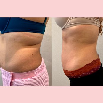 Luxe Studio Beauty - Body Contouring Near Me - Round Rock, Texas Luxe Studio Beauty - Body Contouring Near Me - Round Rock, Texas