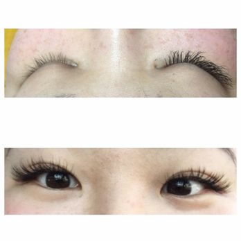 Young Skin Care - Skin Care Near Me - Flushing, New York