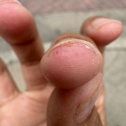 Nail Boutique - Slice from aggressive service.