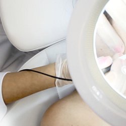 Cantik Esthetics - Skin Tag Removal Surrey BC
