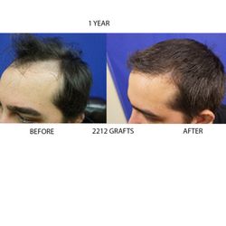 Advanced Medical Hair Institute
