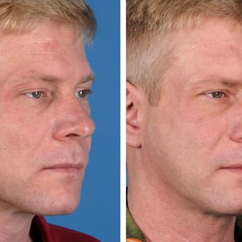 Rao Dermatology - Dermatologists Near Me - Edmonton, Alberta Rao Dermatology - Dermatologists Near Me - Edmonton, Alberta