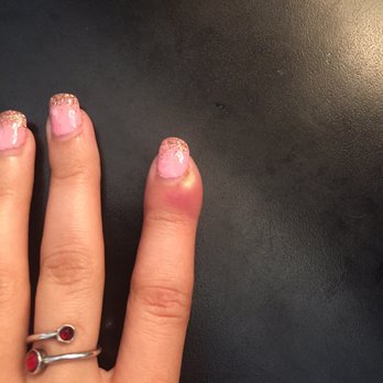 436 Nails & Spa - Cuticle infection- ouch! - Waxing Near Me - Altamonte Springs, Florida