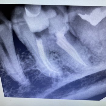 Mahrouz Cohen, DDS - Endodontists Near Me - Encino, California Mahrouz Cohen, DDS - Endodontists Near Me - Encino, California