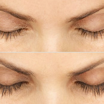 Beth Comeau, MD - Grow longer, thicker eyelashes with Latisse, available from Dr. Comeau. - Medical Spas Near Me - Ellicot City, Maryland