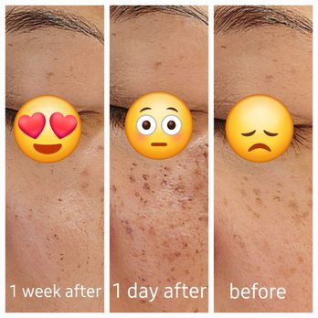 Huntington Dermatology - Lumecca IPL - Dermatologists Near Me - Pasadena, California Huntington Dermatology - Lumecca IPL - Dermatologists Near Me - Pasadena, California