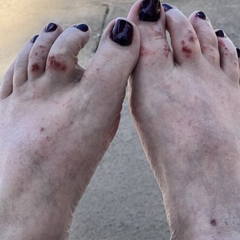 Zen Nails & Spa - Feet day 4 after pedicure on vacation. - Waxing Near Me - Riverton, Utah