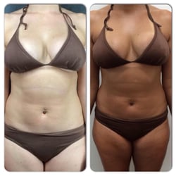 Aventura Spray Tan