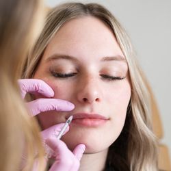 Boss Gal Beauty Bar - Easton - Enhance your lips with a lip filler at Boss Gal Beauty in Columbus Ohio