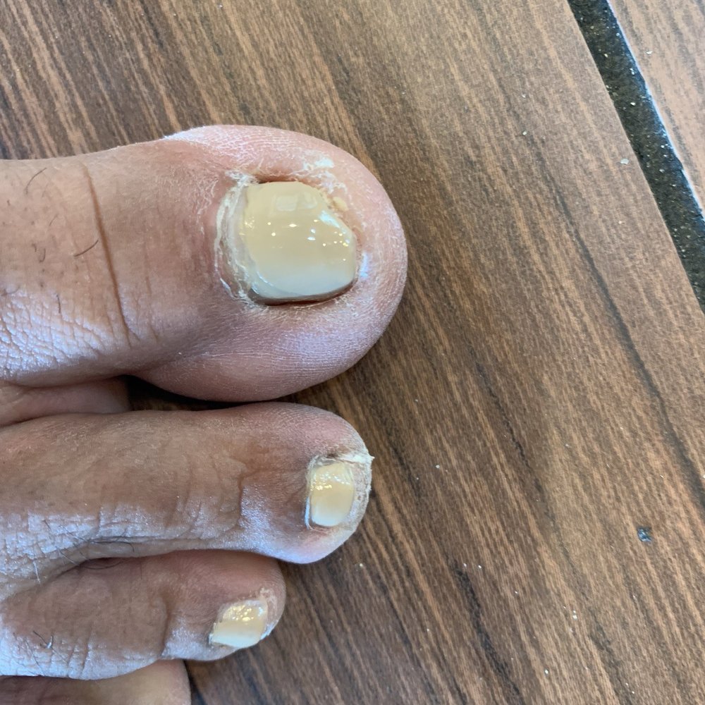 BIJOU Nail Spa - 15 mins after the pedicure. One of the worst nail jobs I ever paid for. - Nail Salons Near Me - Altamonte Springs, Florida BIJOU Nail Spa - 15 mins after the pedicure. One of the worst nail jobs I ever paid for. - Nail Salons Near Me - Altamonte Springs, Florida