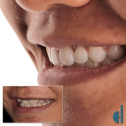 Doncaster Hill Dental