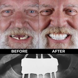 Dental Clinic Tijuana
