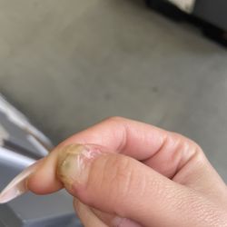 Polish Nail Zone - FUNGUS ON HAND
