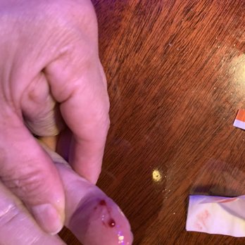 Redwood Cafe - Dad's cut finger with a glass bottom that was broken and should have never been used - New American Near Me - Modesto, California