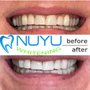 Photo of Novy Skin By Raya