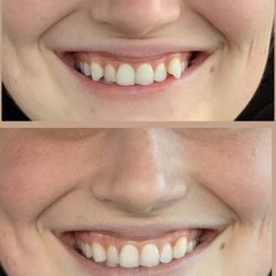 Bielinski and Bono Family Dentistry