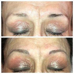 Brow Rescue