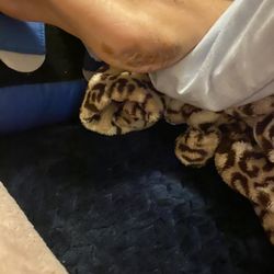 Garden Spring Center - Heel after the surgery when I got osteomyelitis
