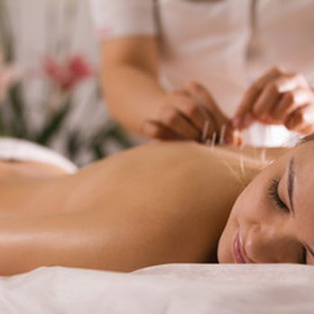 Monarch Acupuncture - Acupuncture calms the nervous system, increases circulation, and eases pain. - Acupuncture Near Me - Snohomish, Washington Monarch Acupuncture - Acupuncture calms the nervous system, increases circulation, and eases pain. - Acupuncture Near Me - Snohomish, Washington