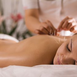 Monarch Acupuncture - Acupuncture calms the nervous system, increases circulation, and eases pain.