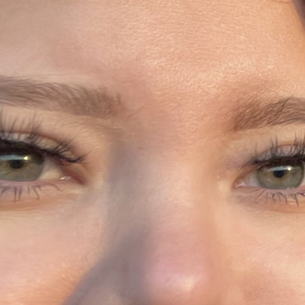Sozer Sadri, MD - Before surgery with dr sozer - Cosmetic Surgeons Near Me - El Paso, Texas Sozer Sadri, MD - Before surgery with dr sozer - Cosmetic Surgeons Near Me - El Paso, Texas