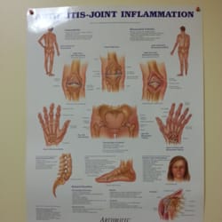 Family Care Medicine - Arthritis-Joint Inflammation Graph