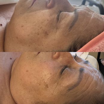 Crystallesthetics - Anti Aging Facial - Skin Care Near Me - Fullerton, California Crystallesthetics - Anti Aging Facial - Skin Care Near Me - Fullerton, California