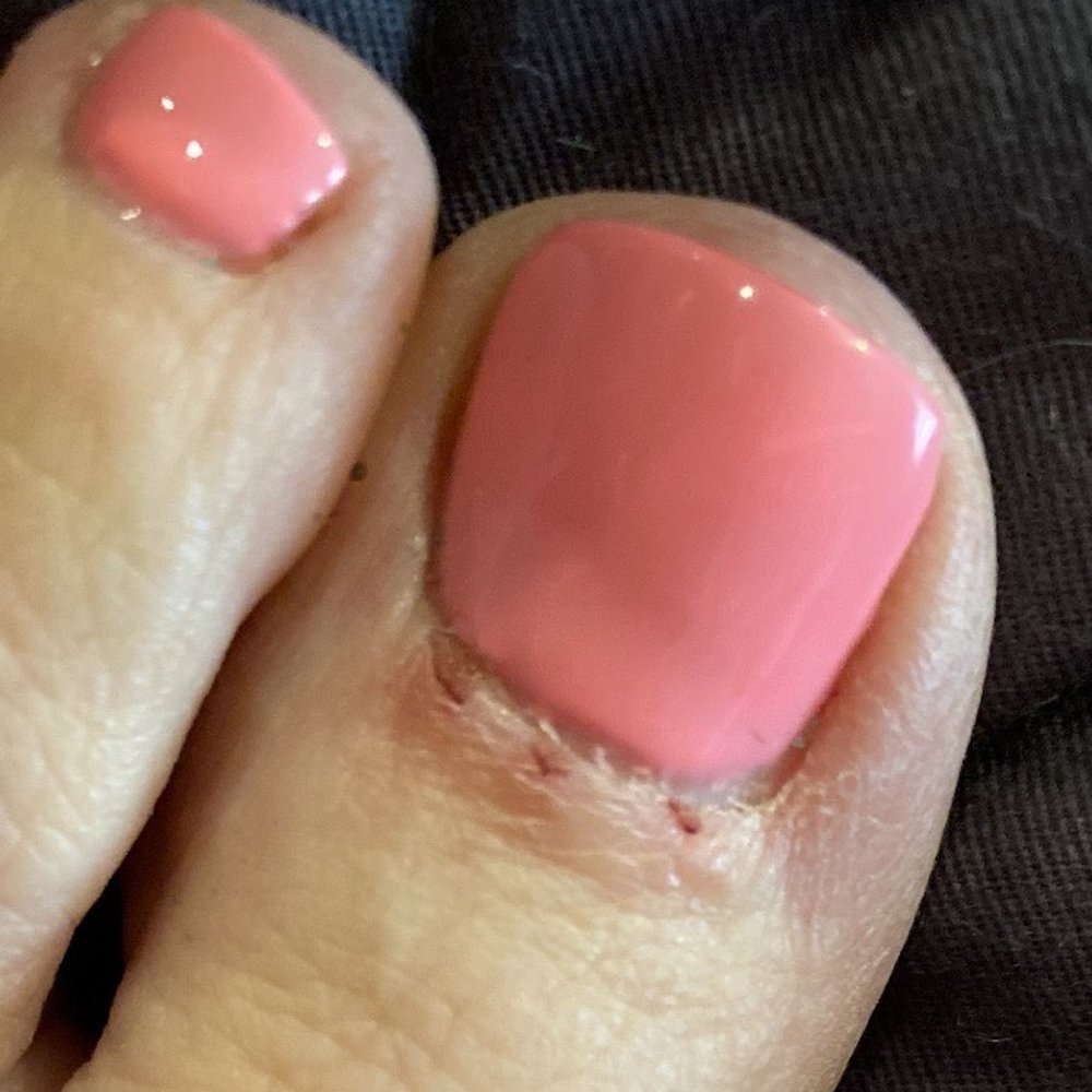 Super Nails One - Cut up :( - Nail Salons Near Me - Long Beach, California Super Nails One - Cut up :( - Nail Salons Near Me - Long Beach, California
