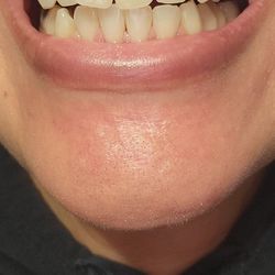 Trinh Joseph Hai DDS - Wonderful cleaning and polishing!