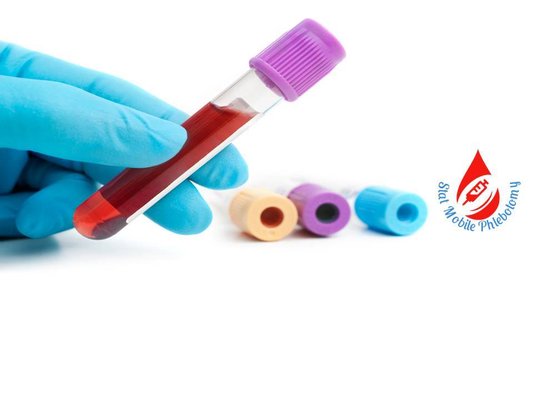Mobile Phlebotomist - Our Mobile Phlebotomy service makes it easy and convenient for you or your patients to get there blood drawn at there place of comfort. You or your patients do not need to come to us we come to you.

Our schedule start as early as 05:00am-10:00pm for STAT and 9:00am-4:00pm for routine.

We service:

Nursing Home facilities
Assisted Living
Adult Day Health care center
Physician offices
Home Health and Hospice Agencies
Blood draws for screening and diagnostic purposes
Research facilities
Non Profit Organization
Independent Laboratories
Self Pay/ Private Home
Physicians offices: We can provide a Phlebotomist for your place of practice at your convenience. Call and ask how to get a phlebotomist stationed at your place of practice.