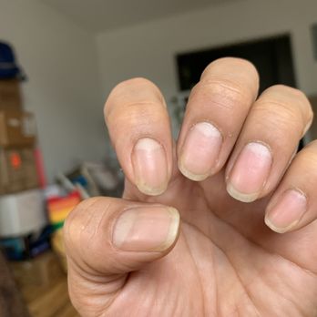 Honey Nail Salon - I got Fungus in my Index finger - Nail Salons Near Me - Brooklyn, New York Honey Nail Salon - I got Fungus in my Index finger - Nail Salons Near Me - Brooklyn, New York