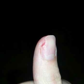 Magic Nails - Destroyed nails from the MMA the salon uses for acrylics - Nail Salons Near Me - Reno, Nevada
