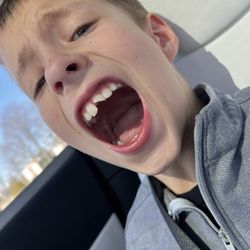 Fishers Pediatric Dentistry - Before