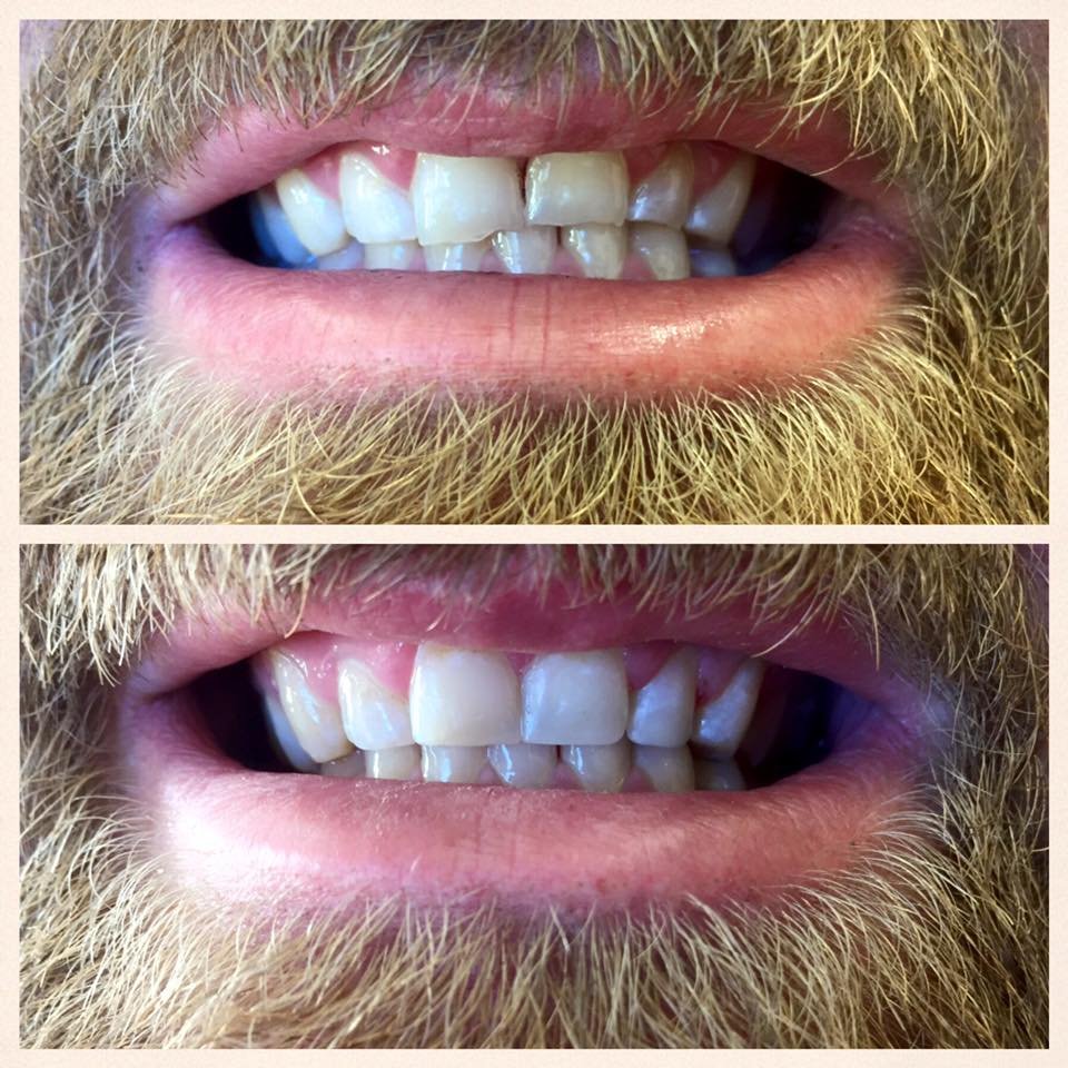 VERDE RIVER DENTAL Updated August 2024 10 Reviews 1660 S State