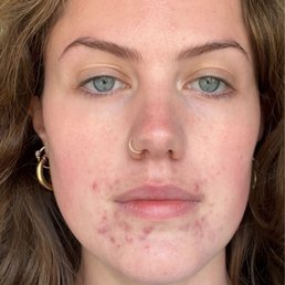 BEFORE (no makeup, filter, edit, etc)